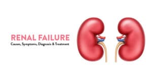 Renal Failure (Kidney Failure): Causes, Symptoms, Diagnosis, and Treatment