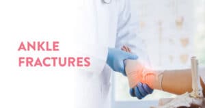 How to deal with Ankle Fractures?