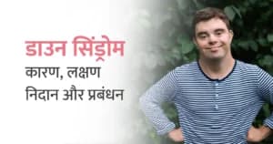 डाउन सिंड्रोम क्या है: कारण, लक्षण, निदान और उपचार