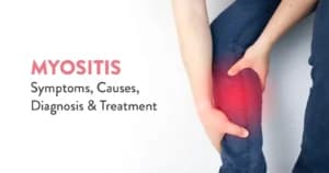 Myositis: Symptoms, Causes, Diagnosis, and Treatment