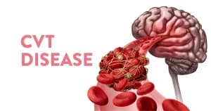 CVT Disease