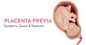 Placenta Previa: Symptoms, Causes, Complications & Treatment Options