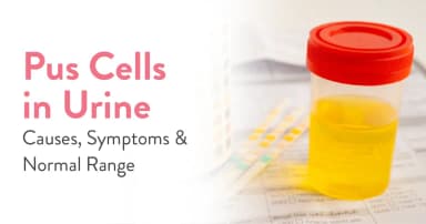 Pus Cells in Urine: Causes, Symptoms and Normal Range