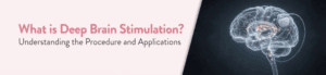 What is Deep Brain Stimulation? Procedure & Recovery Explanation