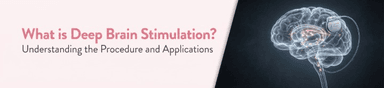 What is Deep Brain Stimulation? Procedure & Recovery Explanation