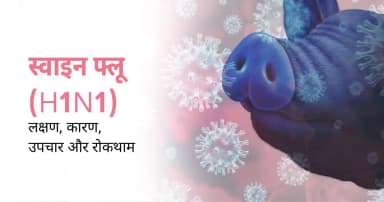 स्वाइन फ्लू (H1N1): लक्षण, कारण, उपचार और रोकथाम