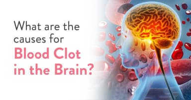 What are the causes for Blood Clot in the Brain?