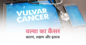 वल्वा का कैंसर क्या है: कारण, लक्षण और इलाज (Vulvar Cancer in Hindi)