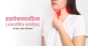 हाइपोथायरायडिज्म का कारण, लक्षण और इलाज
