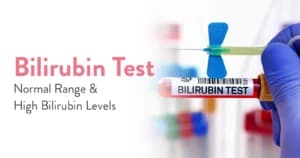 Bilirubin Test: Normal Range, Types, Uses & What High Bilirubin Levels Mean