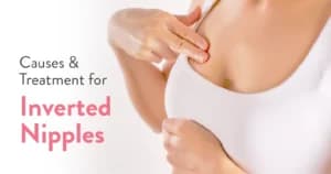 Are Inverted Nipples Normal? Causes & Treatment