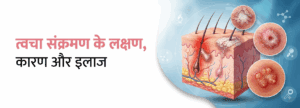 त्वचा संक्रमण के कारण, लक्षण और इलाज (Skin Infection Ke Karan, Lakshan Aur Ilaj)