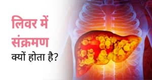 लिवर में संक्रमण क्यों होता है? कारण, लक्षण और बचाव के सटीक उपाय