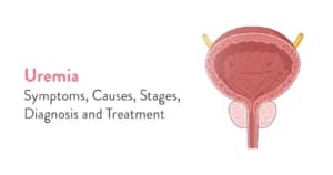 Uremia: Symptoms, Causes, Stages, Diagnosis and Treatment