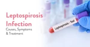 Leptospirosis Infection – Causes, Symptoms and Treatment