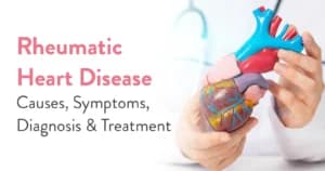 Rheumatic Heart Disease: Causes, Symptoms & Treatment