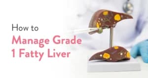 How to Manage Grade 1 Fatty Liver?
