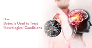 How Botox is Used to Treat Neurological Conditions