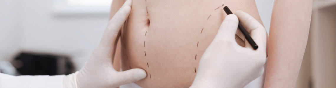 Liposuction, liposuction gurgaon, is liposuction painful