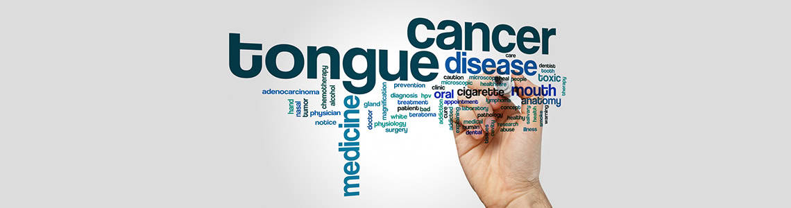 Tongue Cancer Treatment, surgical oncology gurgaon, oral cancer treatment, mouth cancer treatment, oral cancer treatment gurgaon, mouth cancer treatment gurgaon