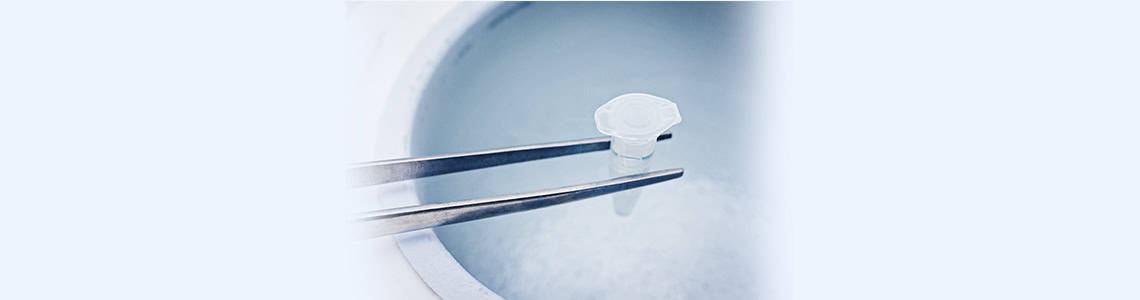 Egg Freezing,IVF