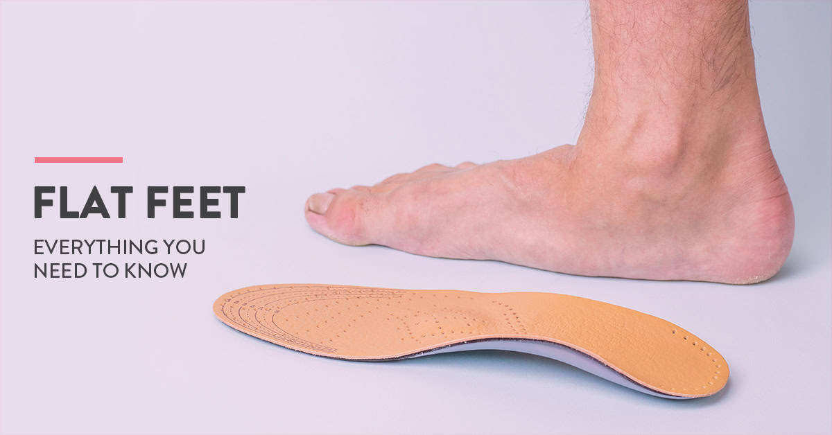 Flat Feet Symptoms, Causes and Cure