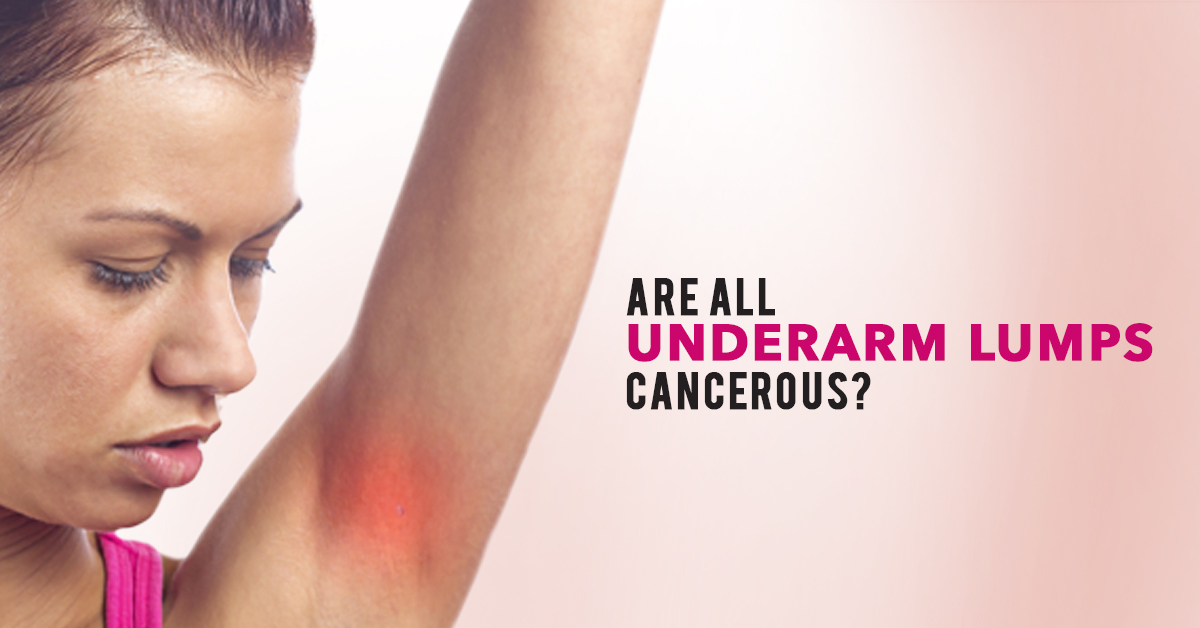 What Does Armpit Pain From Breast Cancer Feel Like Underarm Lump