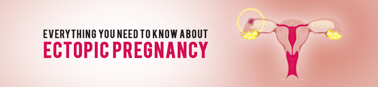ectopic pregnancy, different types of ectopic pregnancy, early signs of ectopic pregnancy, ectopic pregnancy risk factors