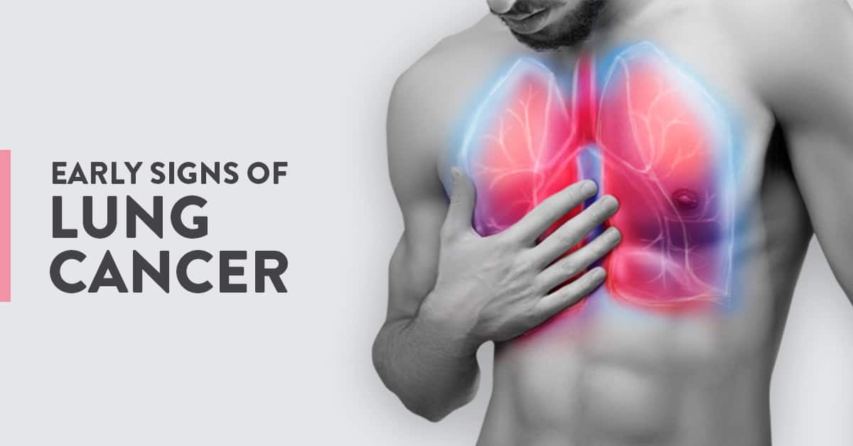 early signs of lung cancer, warning signs of Lung Cancer