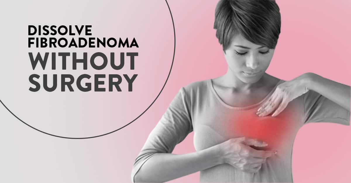 fibroadenoma without surgery, fibroadenoma treatment without surgery, dissolve fibroadenoma naturally, fibroadenoma treatment