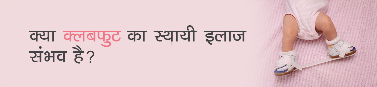 Clubfoot in Hindi, Clubfoot meaning in Hindi, Clubfoot treatment in Hindi
