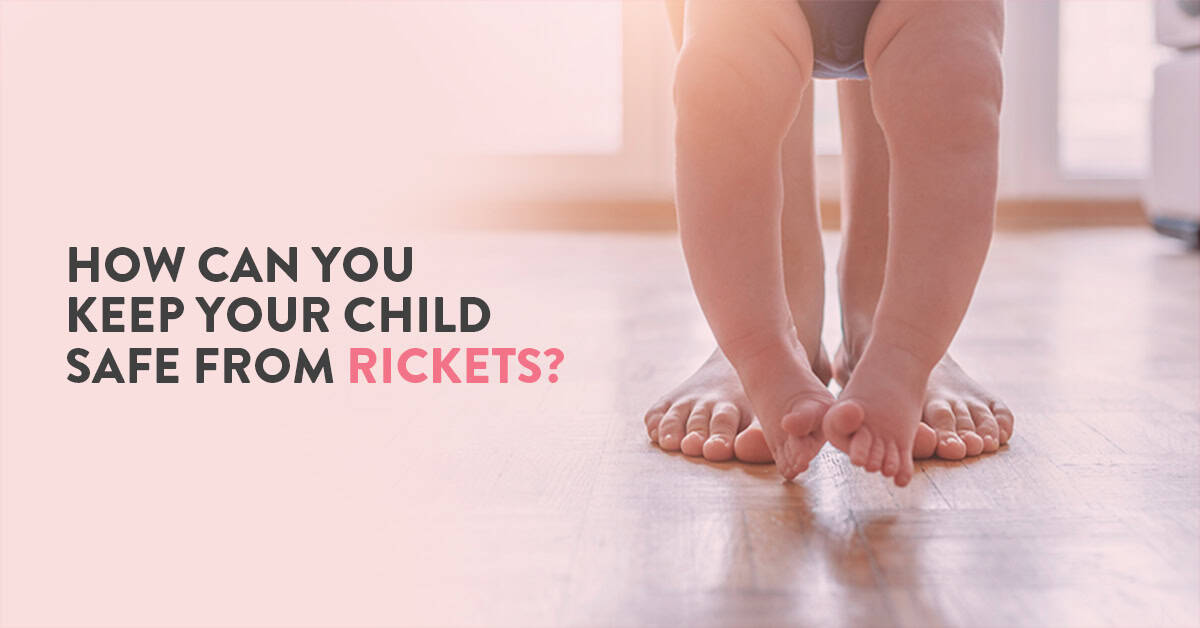 Rickets, what is rickets, Rickets in children, Vitamin D deficiency