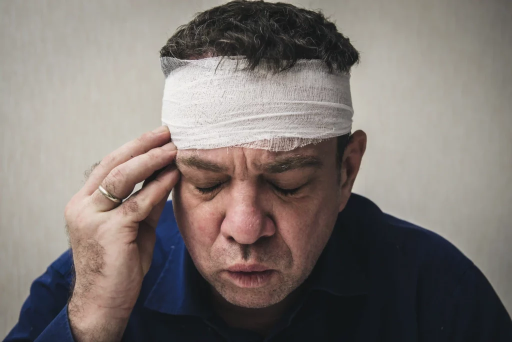 Head Injury Headache Image