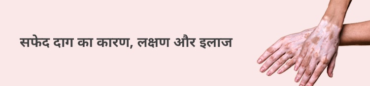 Vitiligo meaning symptoms causes treatment in hindi