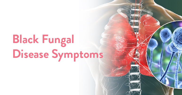 Black Fungal Disease Symptoms thumbnail