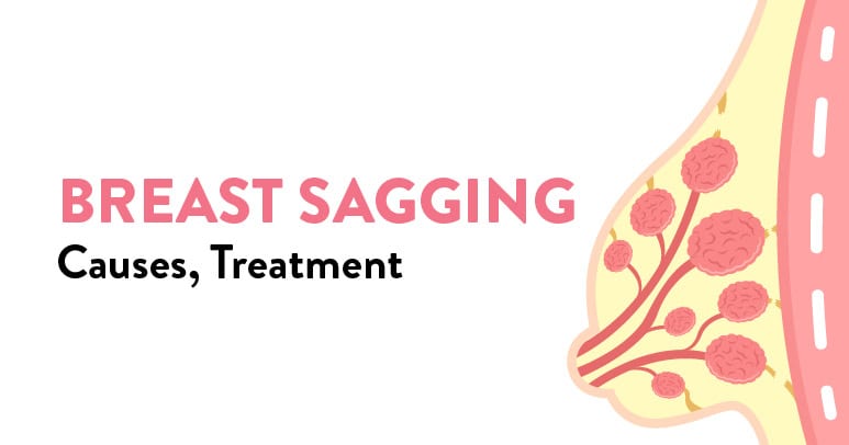 Home Remedies for Sagging Breasts