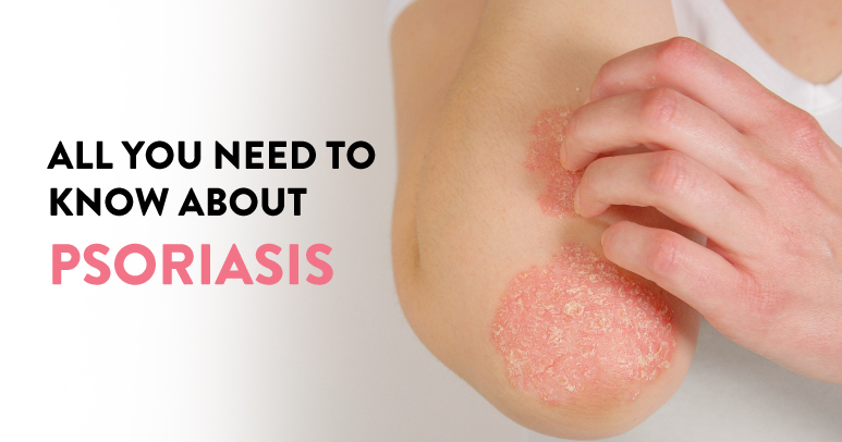 What is Psoriasis and all you need to know