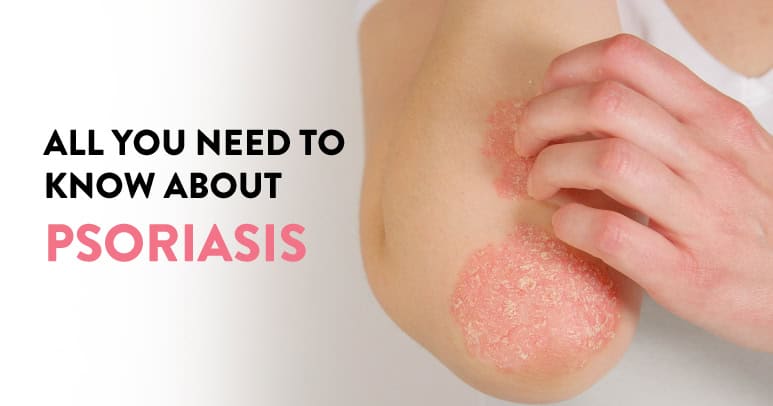 What is Psoriasis and all you need to know