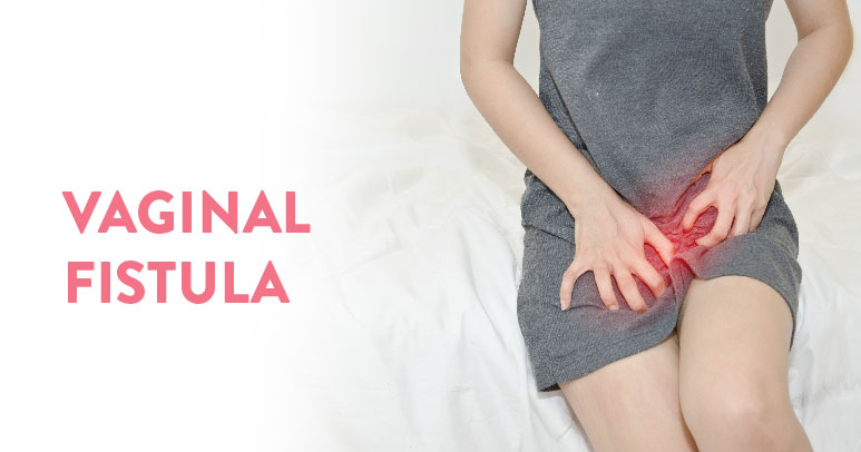 What is vaginal fistula, symptoms and causes