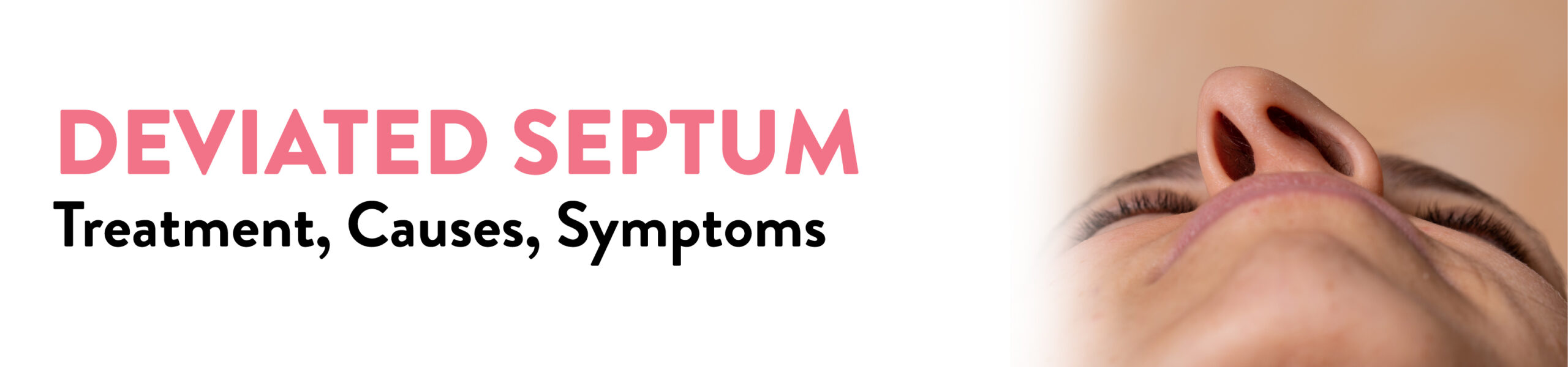 Deviated Septum Treatment Causes and Symptoms