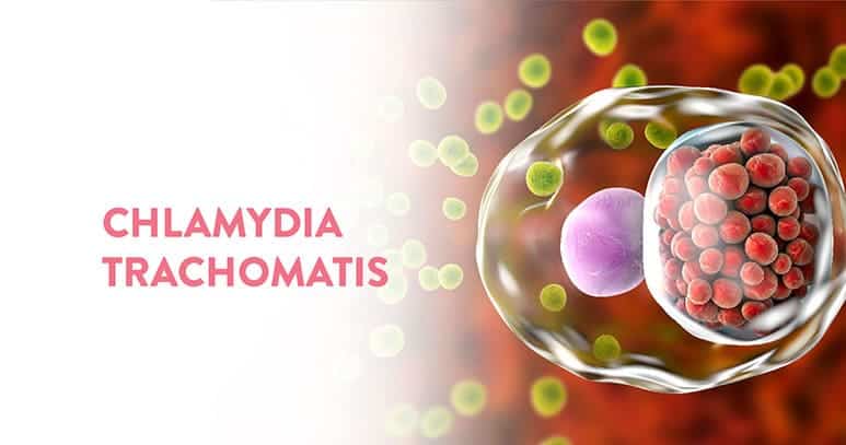 CHLAMYDIA TRACHOMATIS