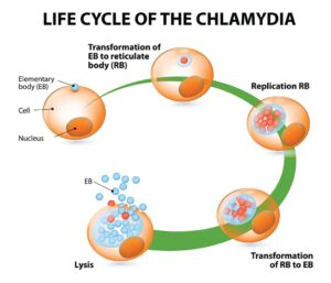 Chlamydia 