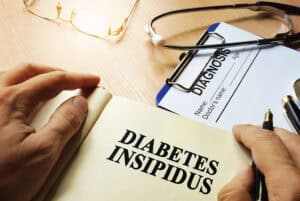 Diabetes Insipidus