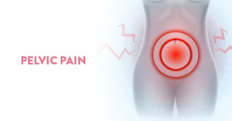 Pelvic Pain