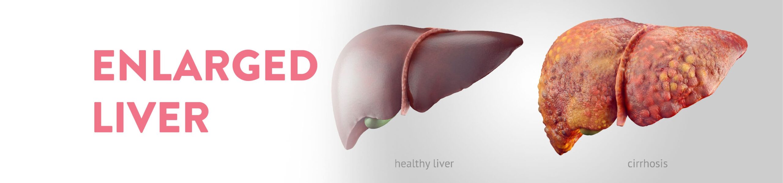 All About Enlarged Liver