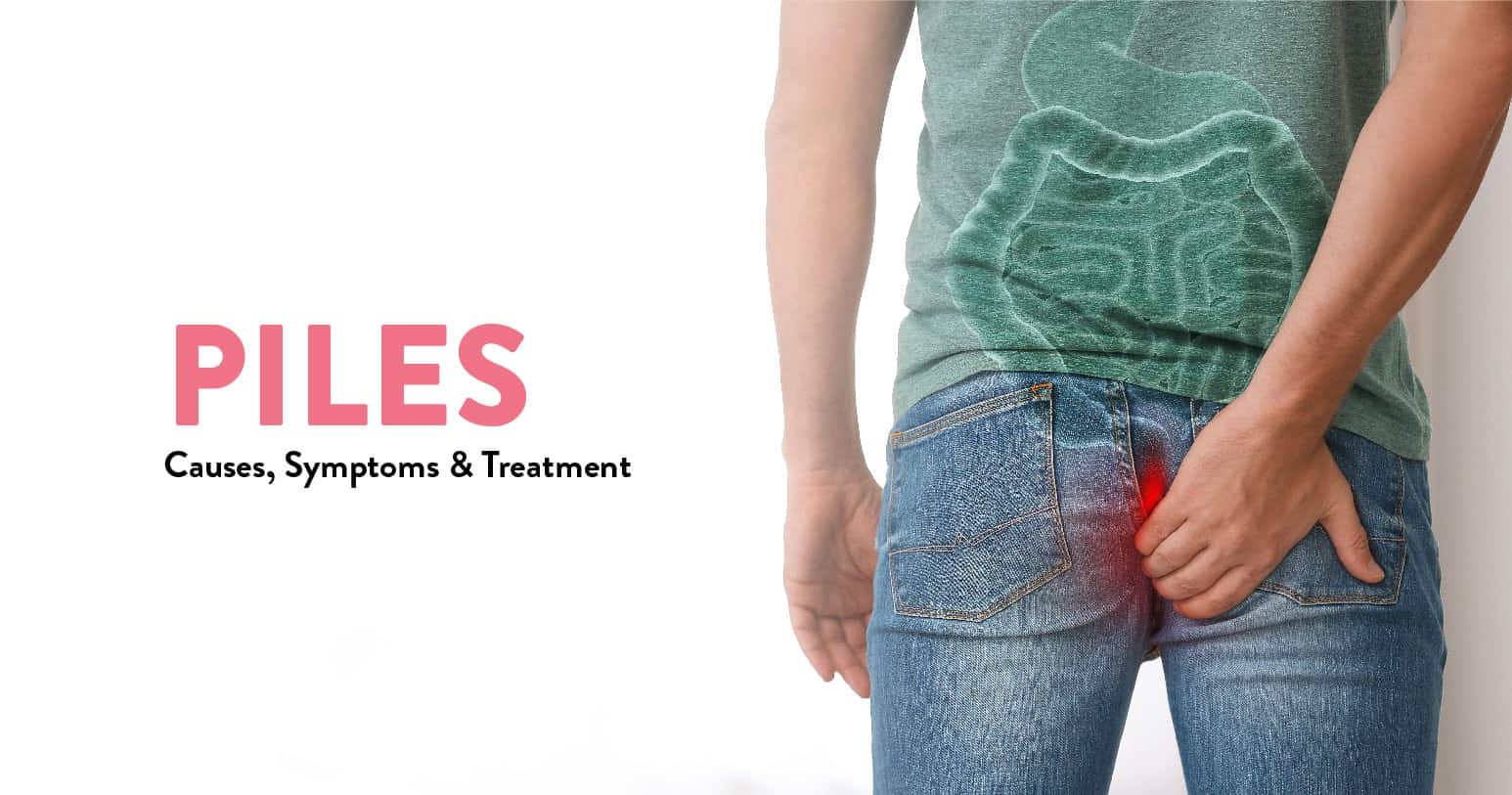 Piles in Men - Problems, Causes, Symptoms and Treatment