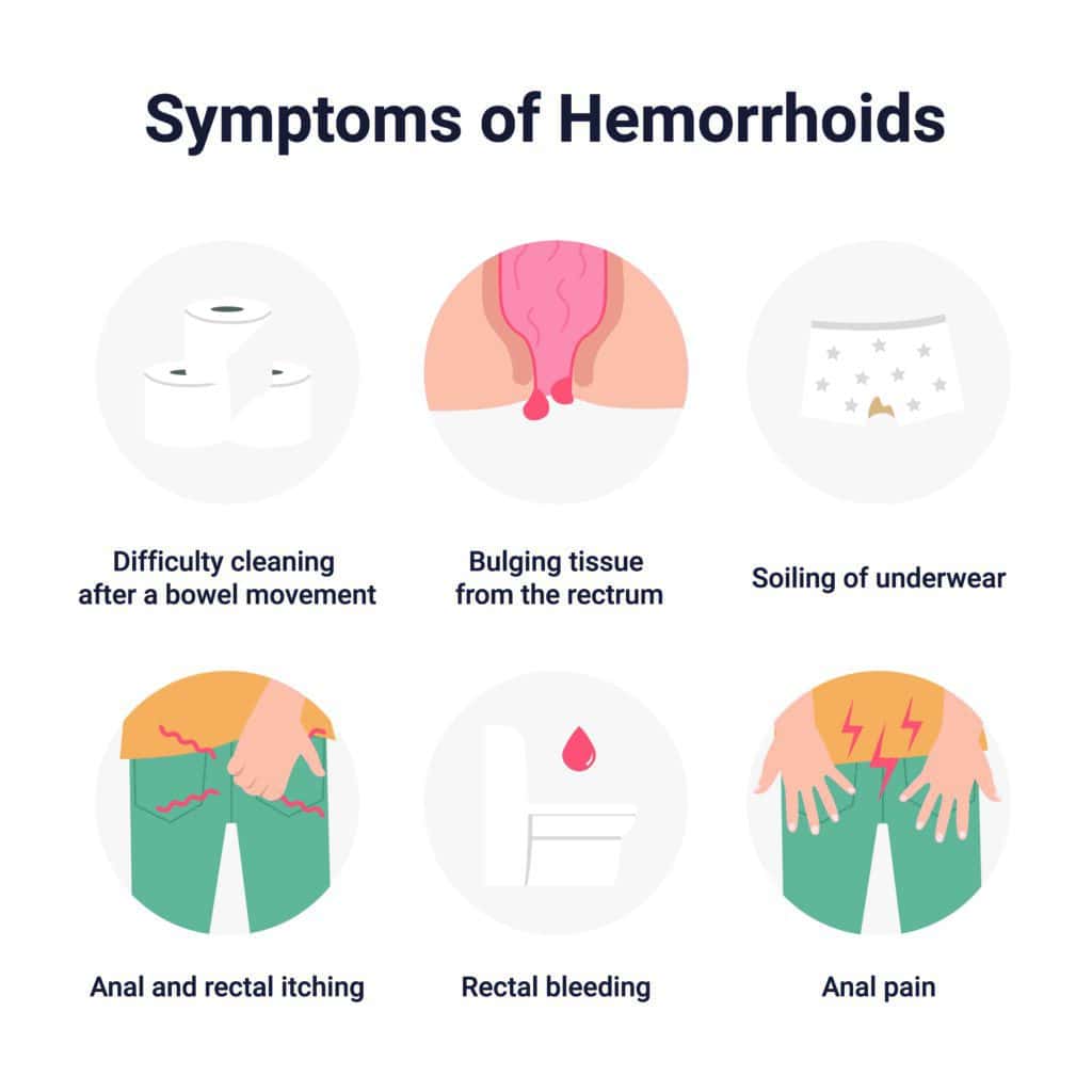 Image showing piles symptoms