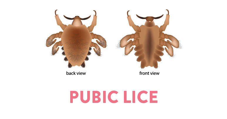 Pubic Lice Thumbnail Link