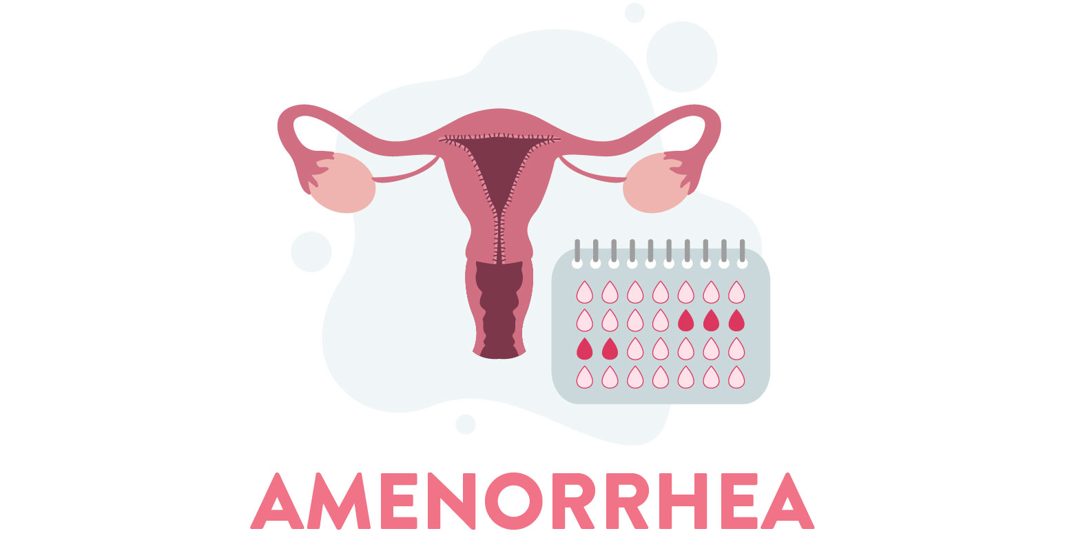All About Amenorrhea