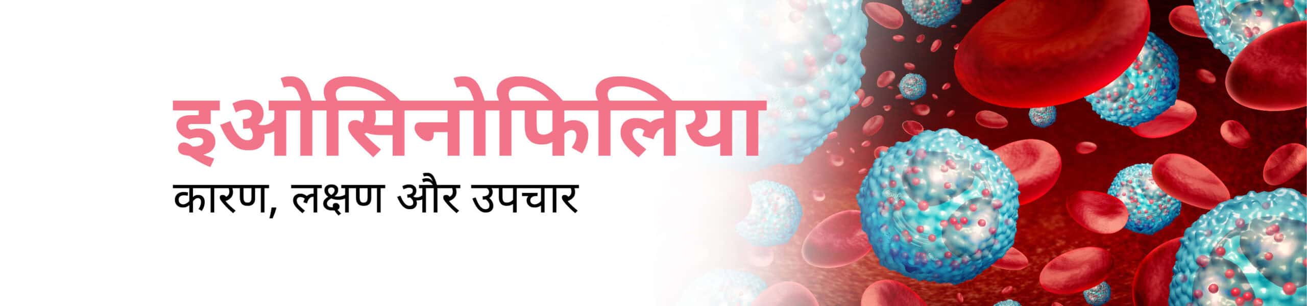 इओसिनोफिलिया क्या है कारण, लक्षण और उपचार Banner